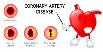 Heart_Disease_2_2258eef9c4